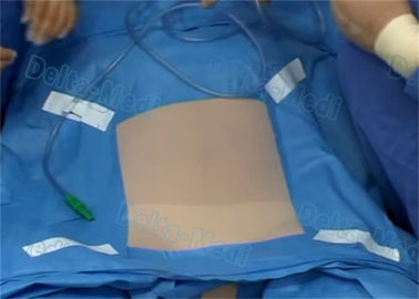 La laparoscopia quirúrgica cubre, paciente disponible estéril cubre con color del azul de ETO
