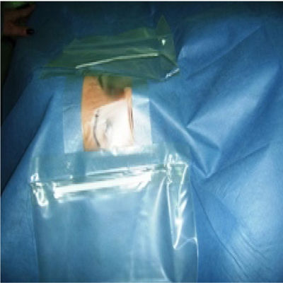 Quirúrgico estéril de la capa múltiple de la oftalmología cubre con la bolsa