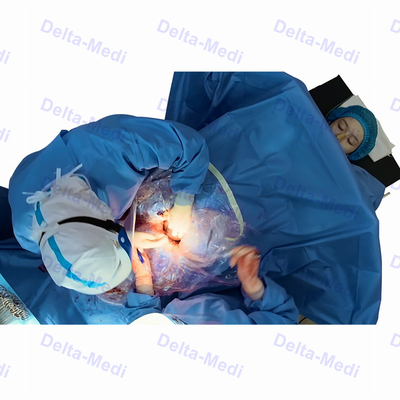 La sección quirúrgica estéril de C cubre con ginecología de Obsterics del hueco cubre el paquete